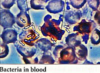 Bacteria in blood